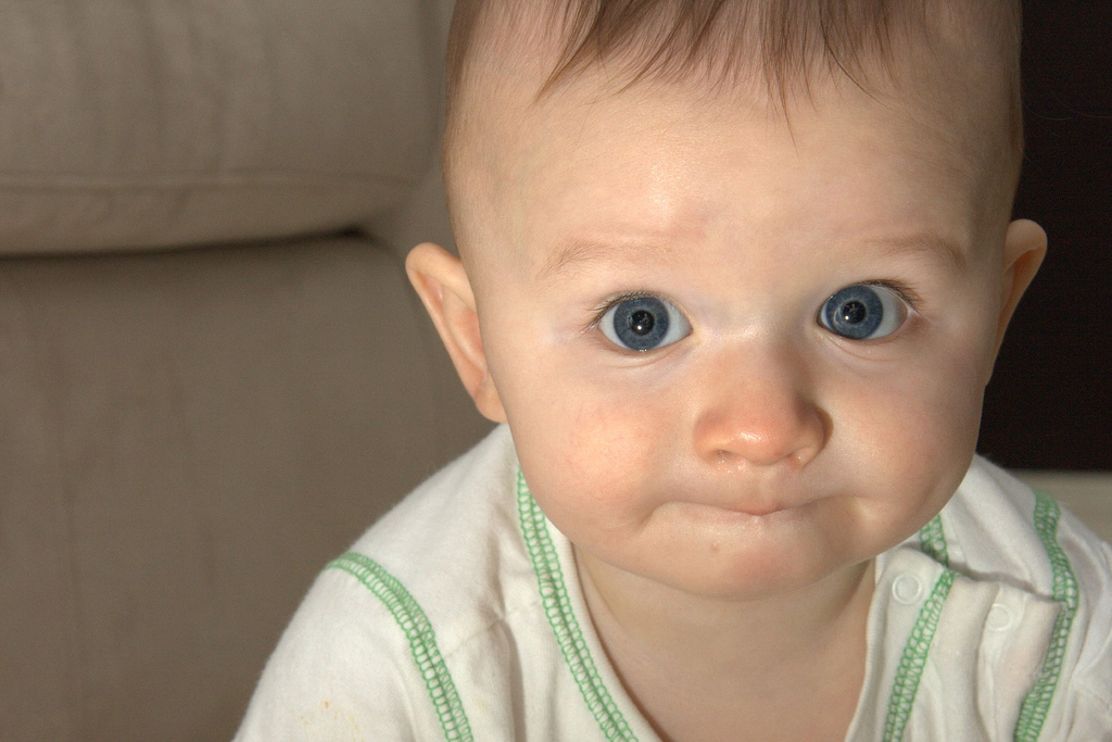 Pinkeye (Conjunctivitis) - HealthyChildren.org
