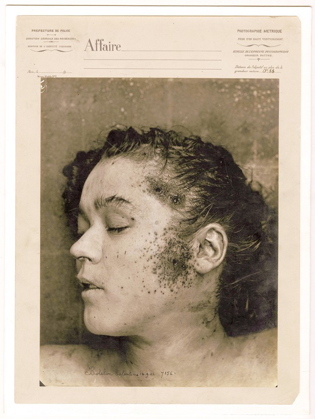 Acid Passion And Dried Blood Photos From Murder Scenes In 1880s Paris